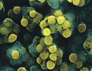 Dezinfectie Streptococie vizualizare cu Microscopul electronic Streptococcus pyogenes